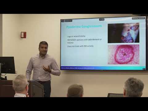 Session 4 Hot Topic_Extraintestinal Manifestations of Inflammatory Bowel Disease [Video]