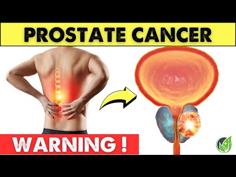 4 Million U.S. Patients With Prostate Cancer Are UNAWARE Of These SIGNS | Health Journey [Video]