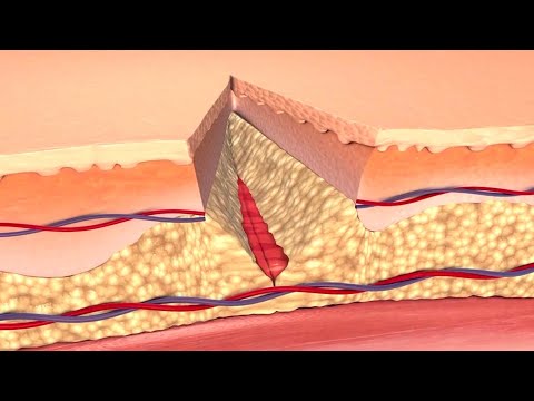 How Your Body Heals Cuts, Scrapes, and Puncture Wounds to the Skin [Video]