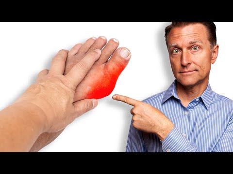 The Ultimate Remedy for Gout and Uric Acid [Video]