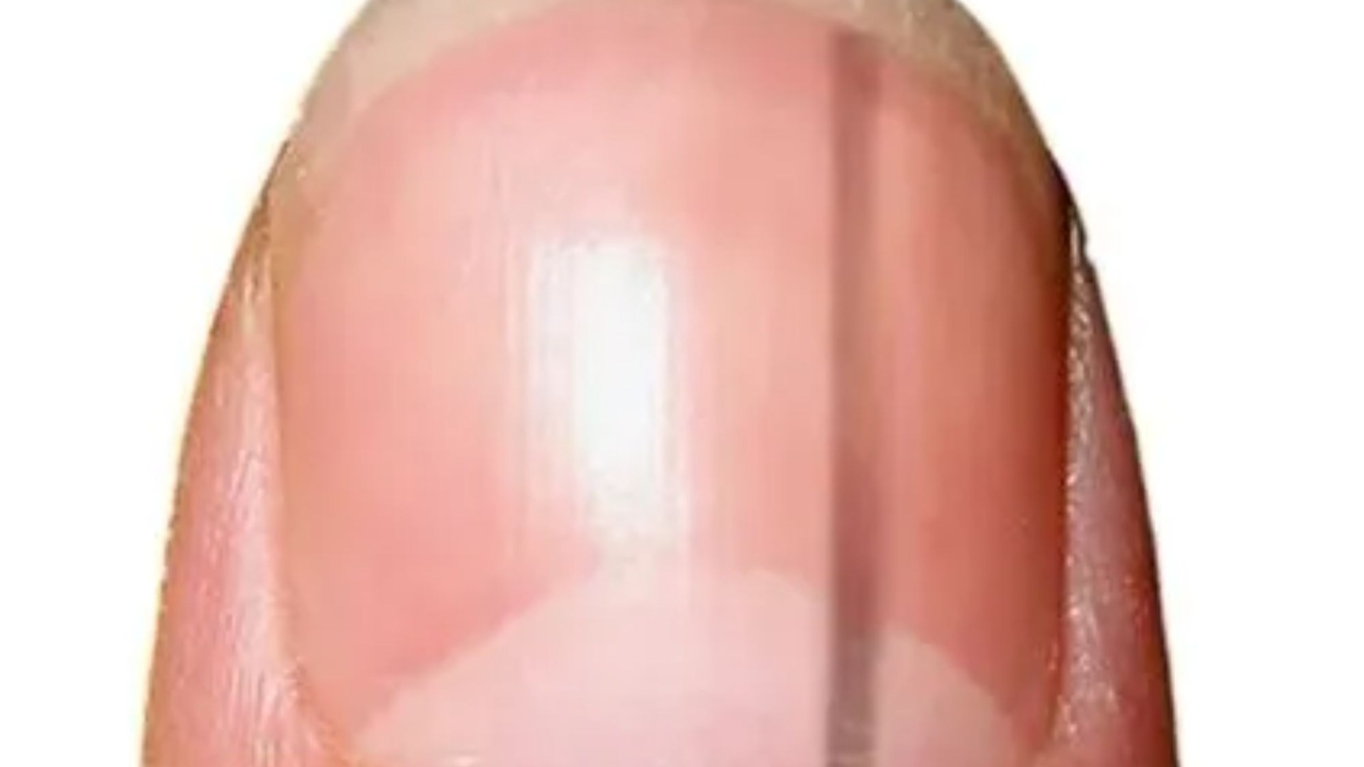 Horrifying time-lapse video shows how nail blemish can morph into killer stage 4 cancer