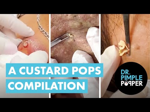 A Custard Pops Compilation 💥 [Video]