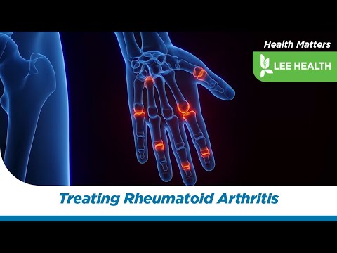 Treating Rheumatoid Arthritis [Video]