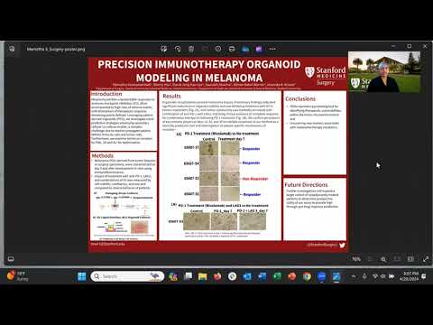 Precision Immunotherapy Organoid Modeling in Melanoma [Video]