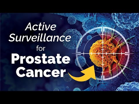 Active Surveillance for Prostate Cancer [Video]