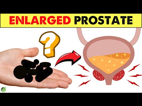 2 SUPER Vitamins Help Fighting Prostate Cancer that You DID NOT Expect | Health Journey [Video]