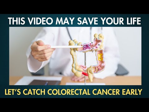11 Early Signs of Colorectal Cancer that you SHOULDN’T IGNORE [Video]