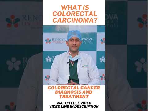 What is Colorectal Carcinoma? || Colorectal Cancer Diagnosis and Treatment || Marella health [Video]