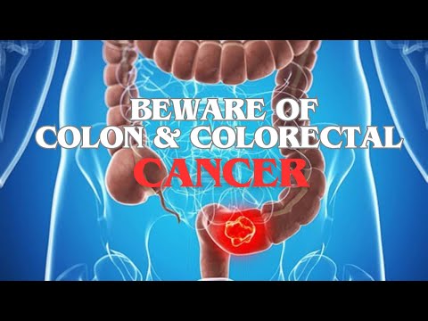 WARNING SIGNS Of Colon And Colorectal Cancer – SEE IF YOU’RE AT RISK [Video]