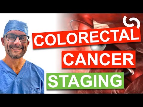 Survival and Staging in Colon and Rectal Cancer [Video]