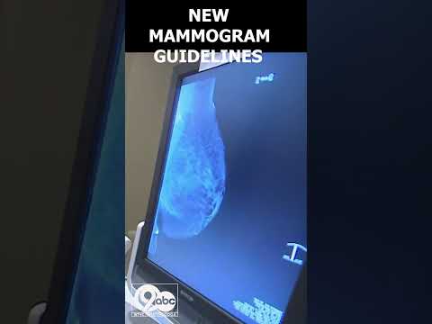New guidelines recommend mammograms for women starting at age 40 [Video]