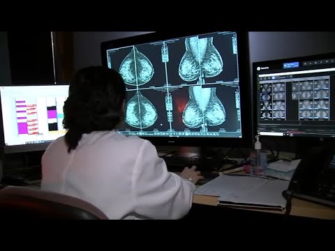 Start screening for breast cancer at age 40, new task force recommends [Video]