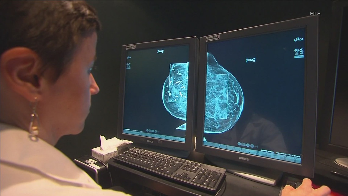 Breast cancer study set to address racial disparities with cancer [Video]