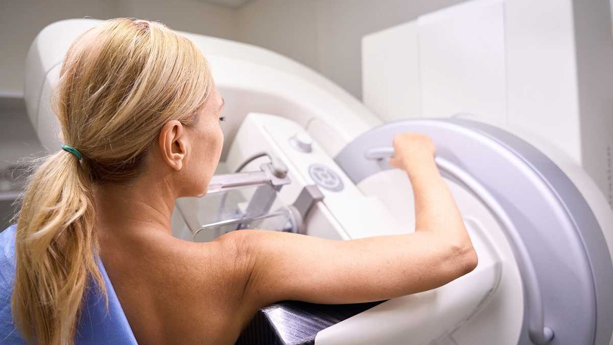 Mammograms are now recommended starting at age 40. Should you get one? [Video]