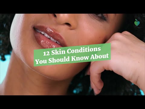 12 Skin Conditions You Should Know About [Video]