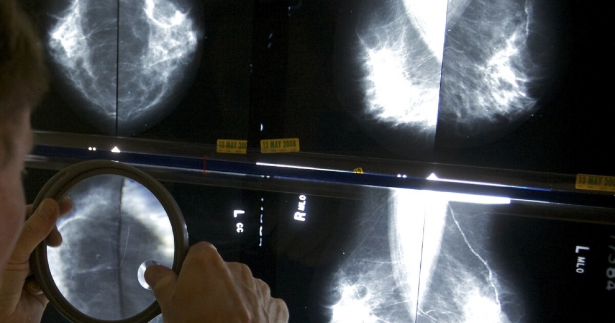 New breast cancer screening guidelines: what you need to know [Video]