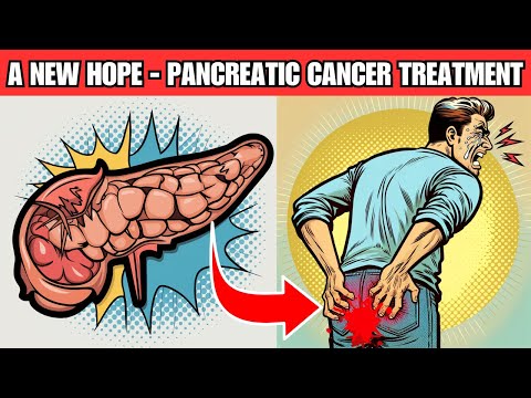 Discover the 5 Latest in PANCREATIC CANCER TREATMENT: A New Hope [Video]