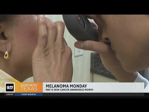 May is skin cancer awareness month! [Video]
