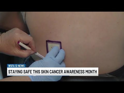 ADPH offers tips on avoiding skin cancer [Video]