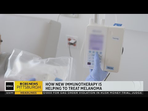 New immunotherapy helping to treat melanoma [Video]