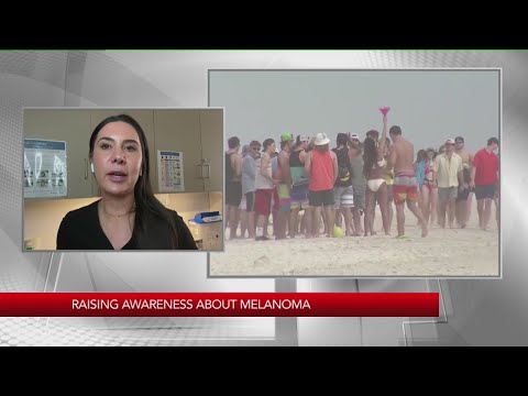 Raising awareness on melanoma Monday [Video]