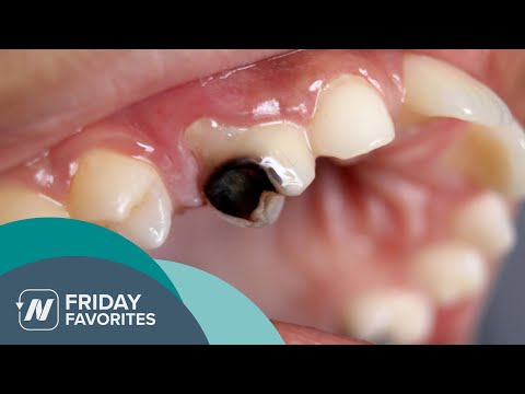 Friday Favorites: How to Stop Tooth Decay [Video]
