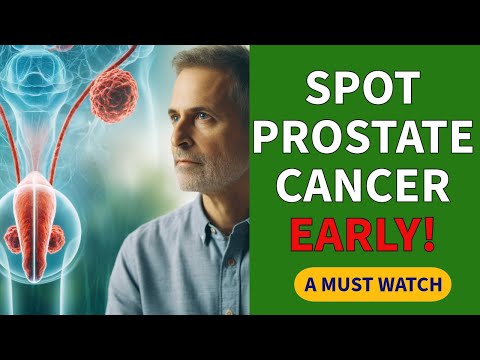Top 10 Warning Signs of Prostate Cancer [Video]