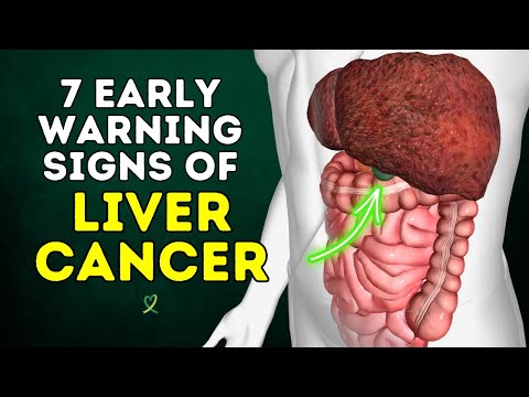 7 Early Warning Signs of Liver Cancer [Video]
