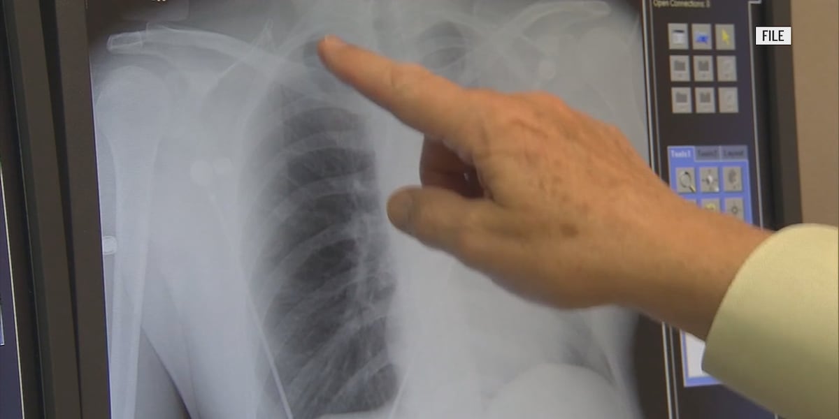 Maine lung cancer rates above national average, experts urge annual screenings [Video]