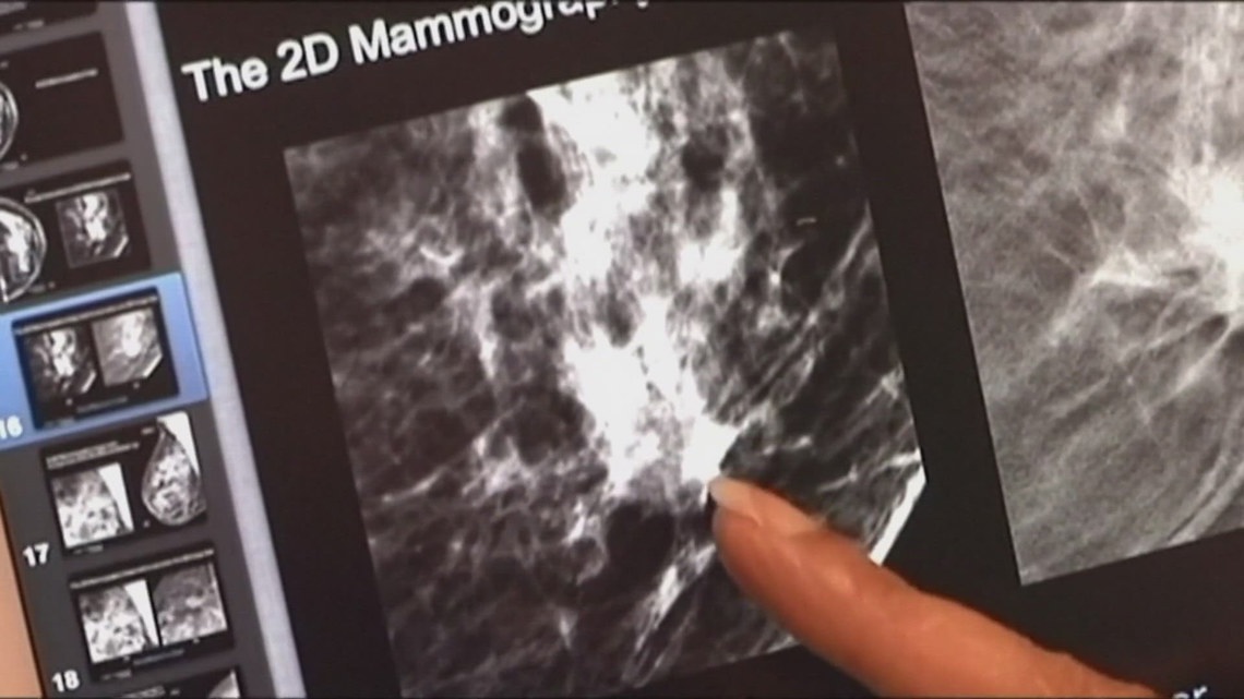 Buddy Check 10: Free breast cancer screenings help save lives in Tennessee [Video]