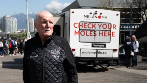 Mole mobiles aim to speed up skin cancer screenings as Canada struggles with dermatologist shortage [Video]