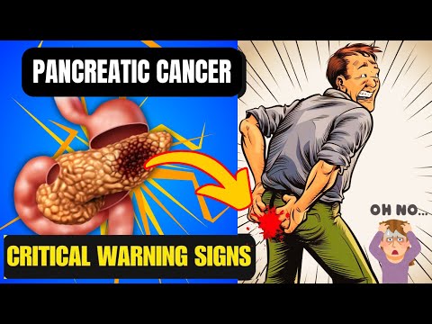 10 Symptoms of PANCREATIC CANCER That Will SHOCK YOU | Critical Warning Signs [Video]