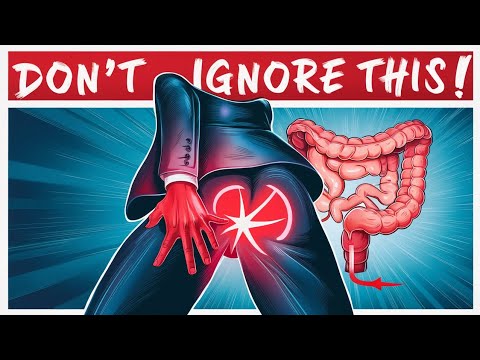 Early Warning Signs Of Colon Cancer You Should Not Ignore [Video]
