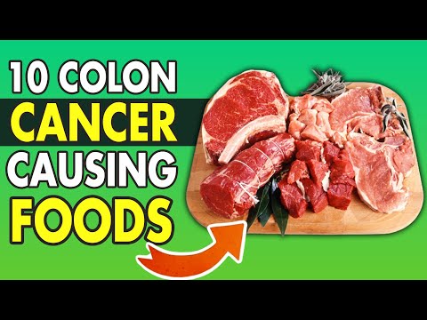TOP 10 WORST Foods for Colon Cancer Prevention [Video]