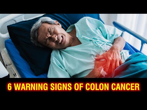 Warning Signs of Colon Cancer [Video]