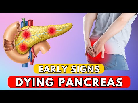 Pancreas is Dying! Early Signs and Symptoms Of Pancreatic Disease [Video]