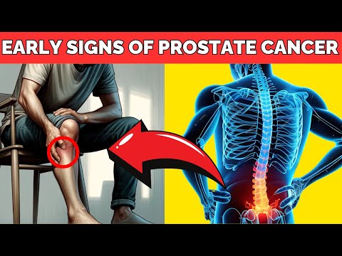 Must Watch! 9 Warning Signs of Prostate Cancer [Video]