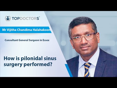 How is pilonidal sinus surgery performed? – Online interview [Video]