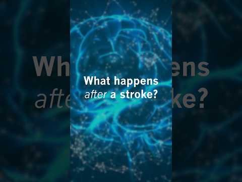 What happens after a stroke? [Video]
