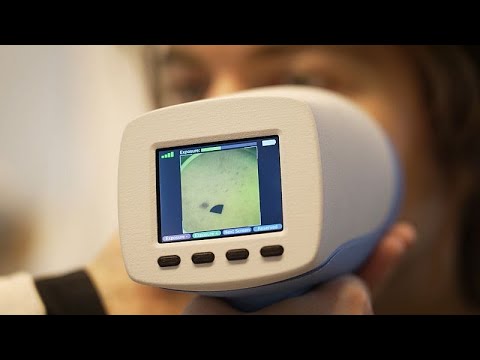 Is this new EU-funded skin cancer screening device a game changer? [Video]