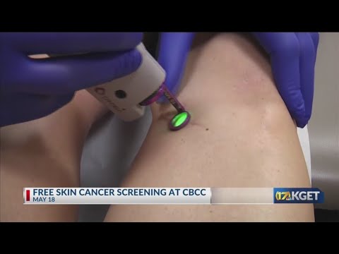 CBCC to offer free skin cancer screenings May 11 [Video]