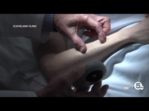 New treatment available for people impacted by this type of skin cancer [Video]