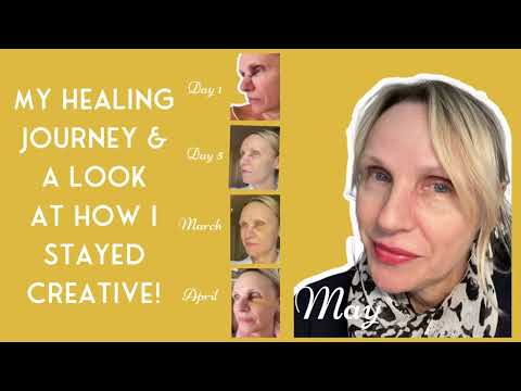 Basal Cell Carcinoma Update and How Staying Creative Was Key. [Video]
