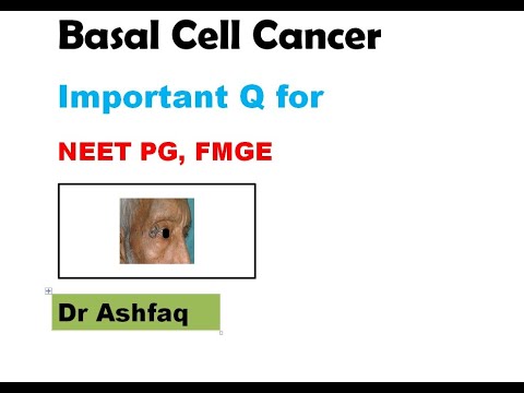 Basal Cell Carcinoma for Neet Pg , FMGE, MBBS, INICET, Dermatology Surgery Residents [Video]