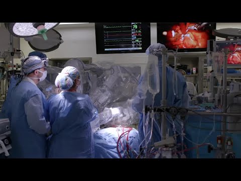 Robotically Assisted Heart Surgery | What to Expect [Video]