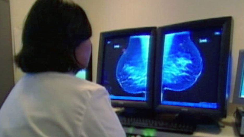 Cancer screening: Early detection saves Canada’s healthcare system millions, uOttawa says [Video]