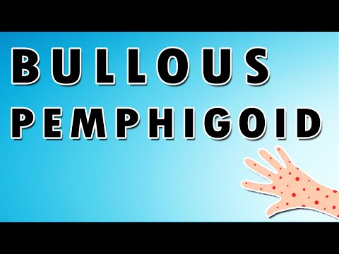 Bullous Pemphigoid Symptoms, Treatment, and Causes [Video]