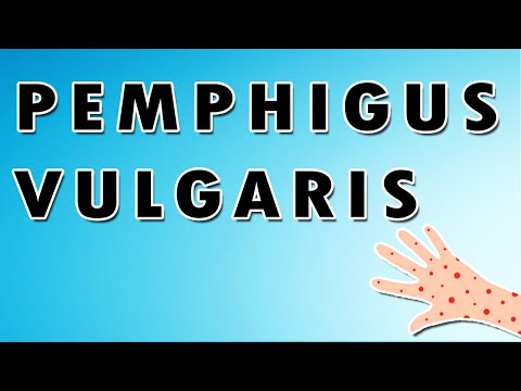 Pemphigus Vulgaris Symptoms, Treatment, and Causes [Video]