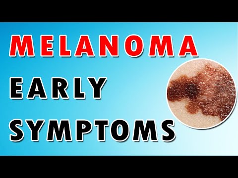 Melanoma Skin Cancer [Video]