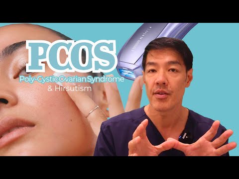 How to treat Excess Hair Growth from PCOS (Hirsutism) with IPL [Video]